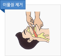 이물질 제거